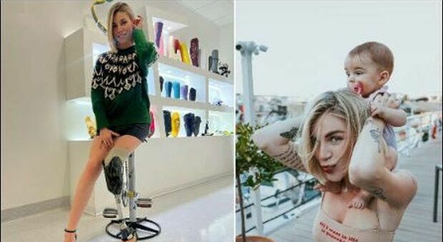 Nina Rima, la modella che ha perso una gamba in un incidente: «Voglio essere una speranza per chi si sente emarginato»