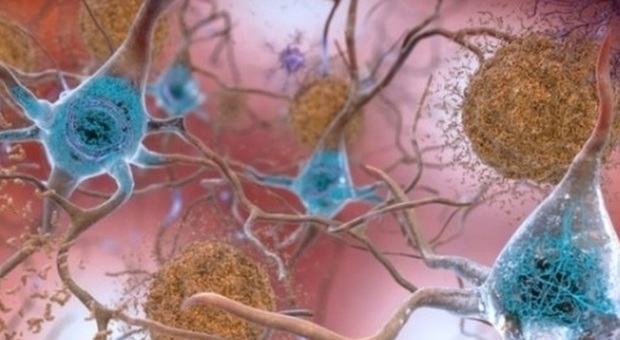 Alzheimer, scoperto il modo in cui i neuroni sfuggono alla "morte": lo studio