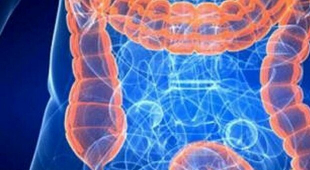 Tumore al colon retto, trovata la cura: la scoperta dei ricercatori di Università di Torino e IFOM Milano