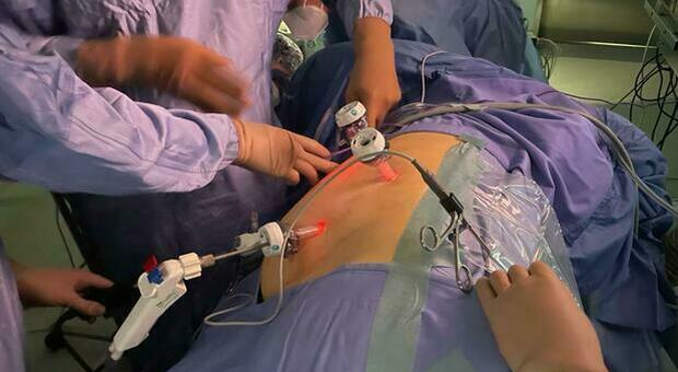 Tumore congelato e asportato in ospedale con la crioablazione: l'intervento innovativo a Taranto