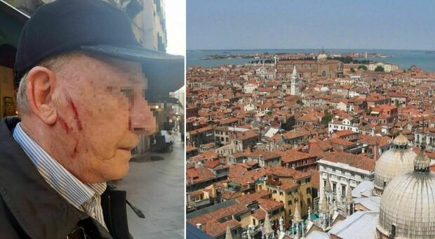 Follia a Venezia, 80enne sventa un furto: le borseggiatrici lo aggrediscono con graffi sul volto. Anziano-eroe insanguinato