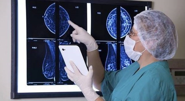 Tumore al seno, a Monza lo studio sperimentale per curarlo senza chemio