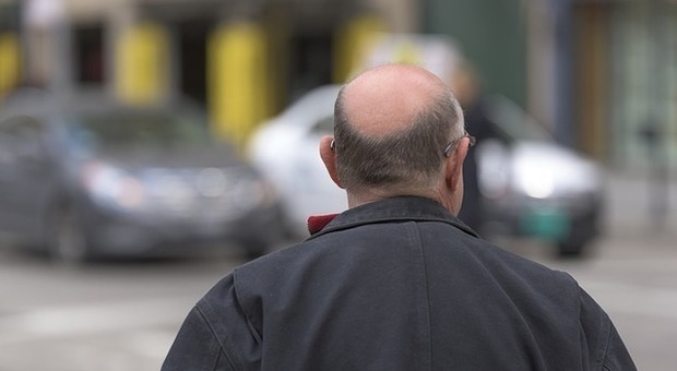 «Farmaco contro la caduta dei capelli mi ha reso impotente»: la denuncia di un 35enne a Milano