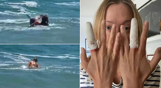 Attrice aggredita da una foca finisce in ospedale: «Mi ha morsa sei volte». Scene di panico in spiaggia